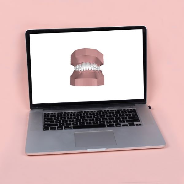 3D dental scan