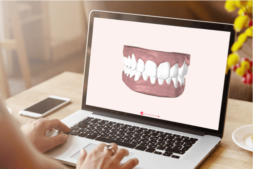 صورة ثلاثية الأبعاد لابتسامة العميل الجديدة تظهر على شاشة الحاسوب الموجود على طاولة إلى جانبه هاتف محمول